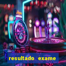 resultado exame eliel figueiredo